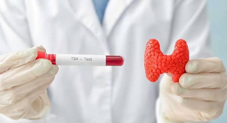 Thyroid and hormone laboratory analysis